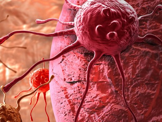 خوراکیهایی که خاصیت ضد سرطانی دارند